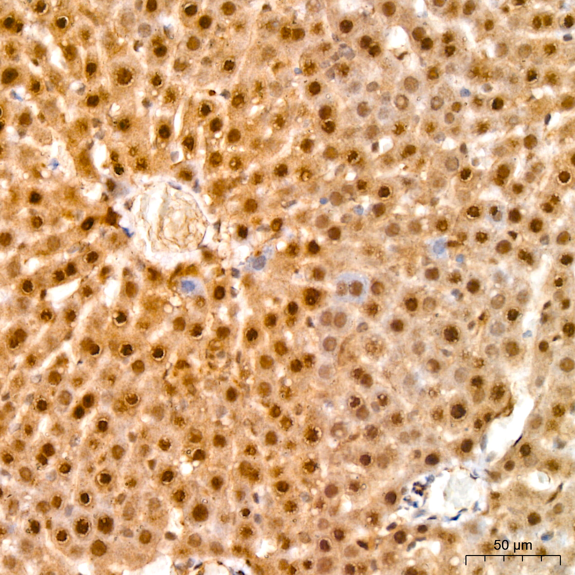 UBE2L6 Rabbit monoclonal antibody