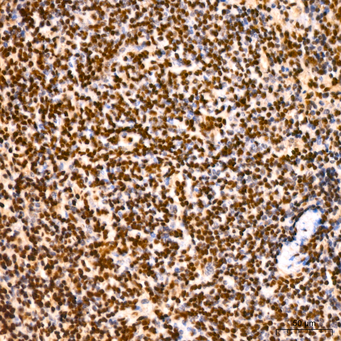 LIM kinase 1(LIMK1) Rabbit monoclonal antibody