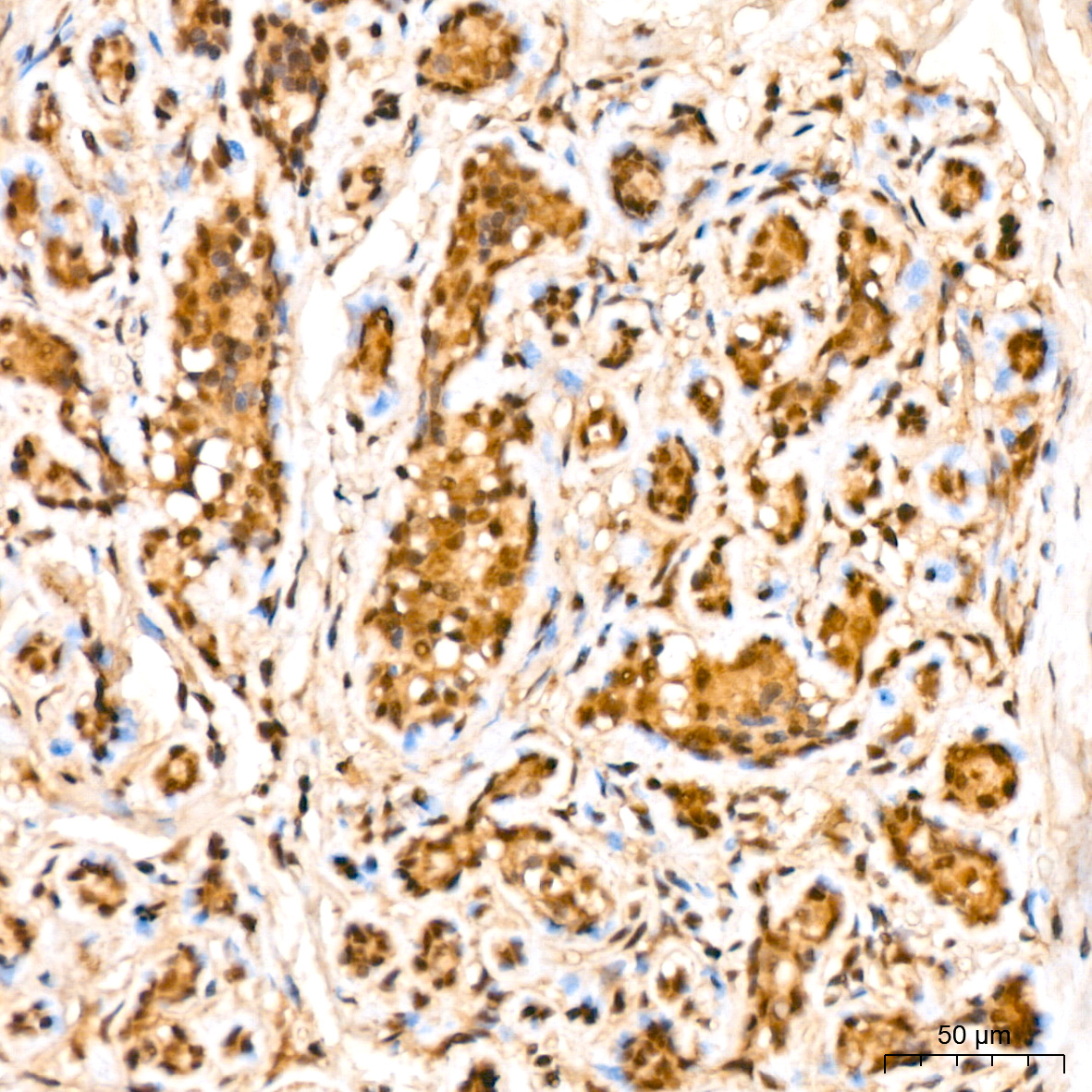 LIM kinase 1(LIMK1) Rabbit monoclonal antibody