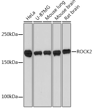 ROCK2 Rabbit monoclonal antibody