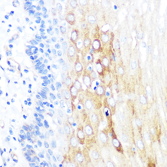 ROCK2 Rabbit monoclonal antibody