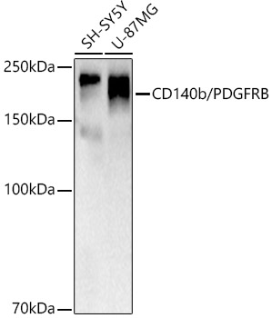 CD140b/PDGFRB Rabbit mAb