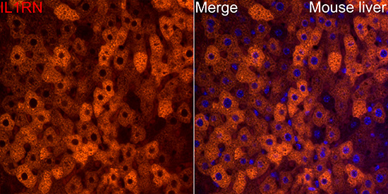 IL-1RA Rabbit monoclonal antibody