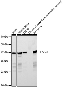 HSP40 Rabbit monoclonal antibody
