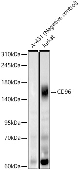 CD96 Rabbit monoclonal antibody