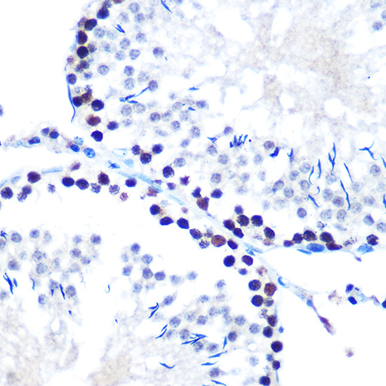mSin3A Rabbit monoclonal antibody