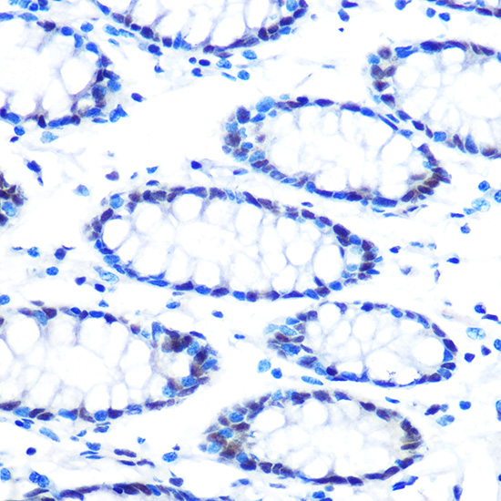 mSin3A Rabbit monoclonal antibody