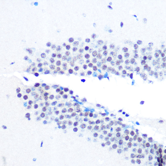 mSin3A Rabbit monoclonal antibody