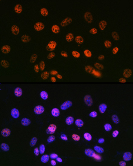 mSin3A Rabbit monoclonal antibody