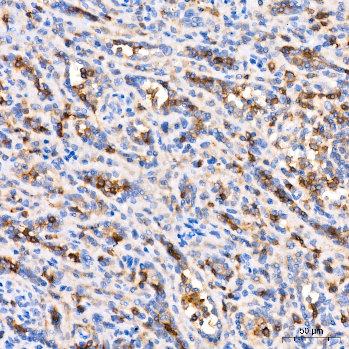 CD11a Rabbit monoclonal antibody