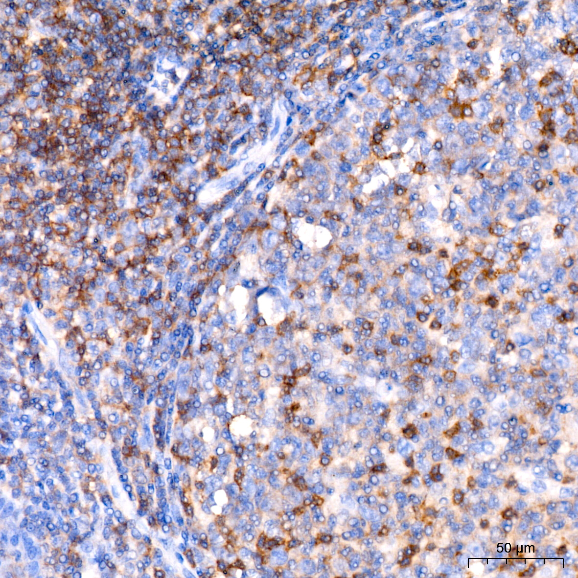 CD11a Rabbit monoclonal antibody