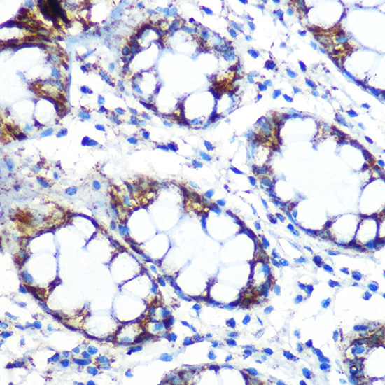 Peroxiredoxin 3 (PRDX3) Rabbit monoclonal antibody