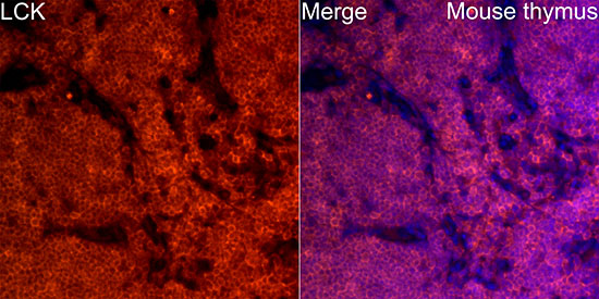 LCK Rabbit monoclonal antibody