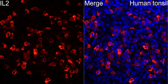IL2 Rabbit monoclonal antibody