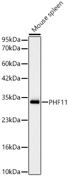 [KD Validated] PHF11 Rabbit monoclonal antibody