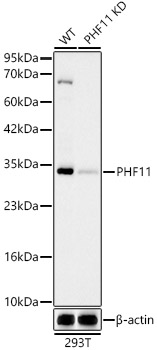 [KD Validated] PHF11 Rabbit monoclonal antibody