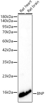 BNP Rabbit monoclonal antibody