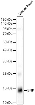 BNP Rabbit monoclonal antibody