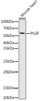 PLGF Rabbit monoclonal antibody