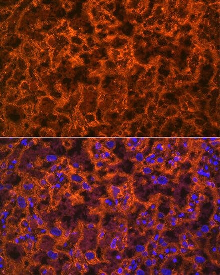 PLGF Rabbit monoclonal antibody