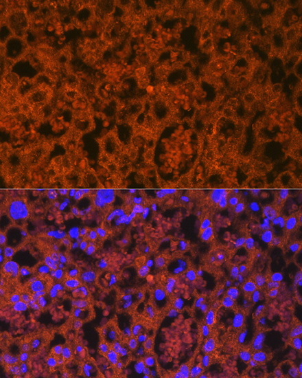 PLGF Rabbit monoclonal antibody