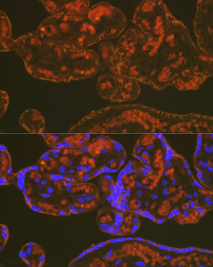PLGF Rabbit monoclonal antibody