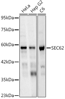 SEC62 Rabbit monoclonal antibody