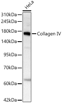 Collagen IV Rabbit monoclonal antibody