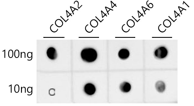 Collagen IV Rabbit monoclonal antibody