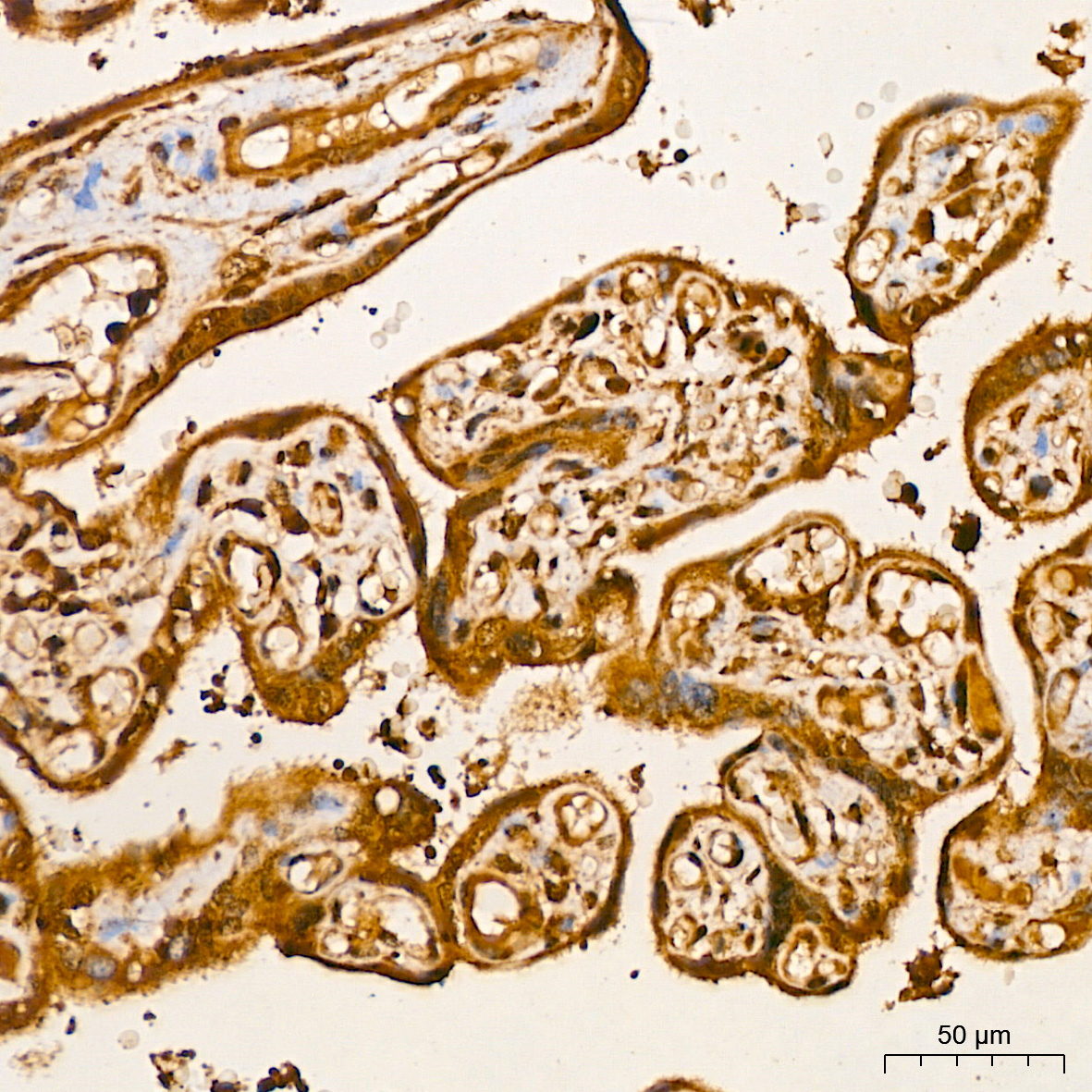 AKT2 Rabbit monoclonal antibody