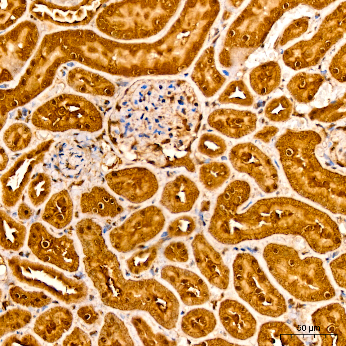 AKT2 Rabbit monoclonal antibody