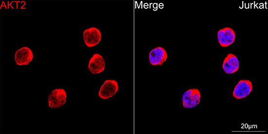 AKT2 Rabbit monoclonal antibody