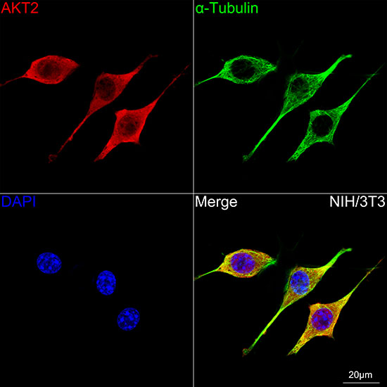 AKT2 Rabbit monoclonal antibody