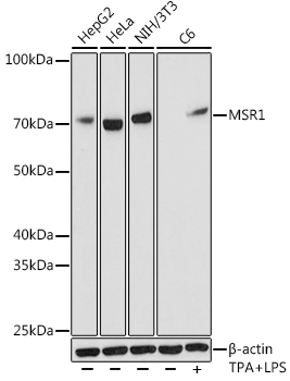 MSR1 Rabbit monoclonal antibody