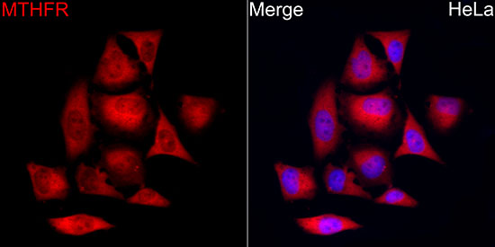 MTHFR Rabbit monoclonal antibody