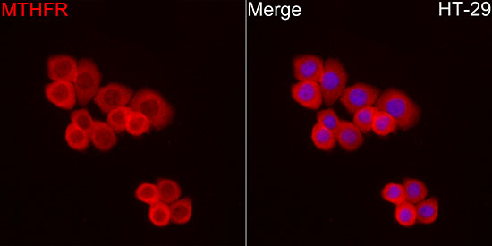MTHFR Rabbit monoclonal antibody