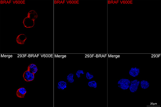 BRAF V600E Rabbit monoclonal antibody