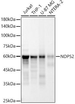 [KD Validated] NDP52 Rabbit monoclonal antibody