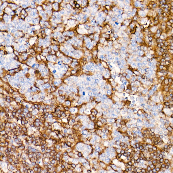 CD44 Rabbit monoclonal antibody