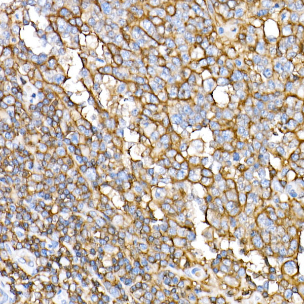 CD44 Rabbit monoclonal antibody