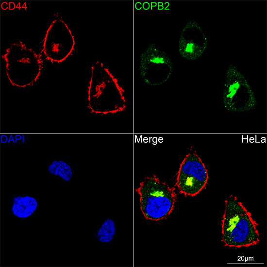 CD44 Rabbit monoclonal antibody