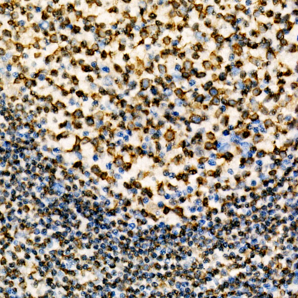 CD74 Rabbit monoclonal antibody