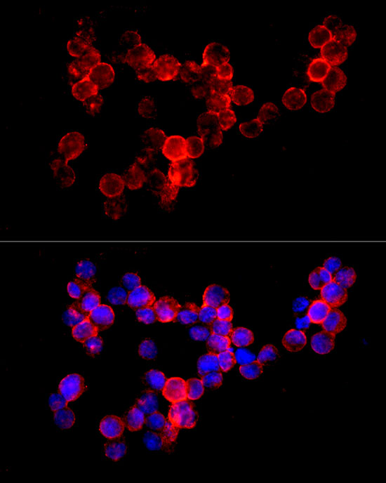 CD74 Rabbit monoclonal antibody