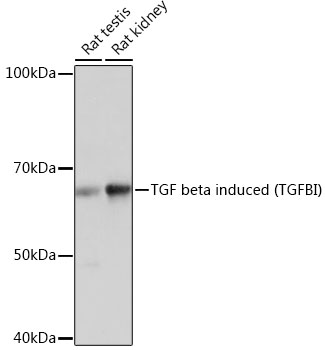 TGF beta induced (TGFBI) Rabbit monoclonal antibody