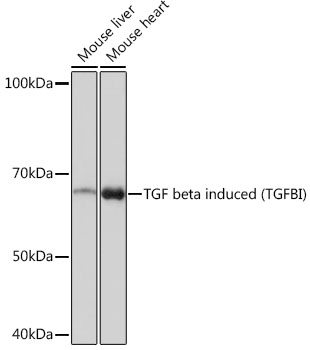 TGF beta induced (TGFBI) Rabbit monoclonal antibody