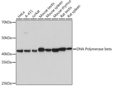 DNA Polymerase beta Rabbit monoclonal antibody