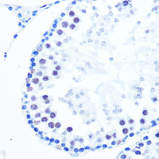 DNA Polymerase beta Rabbit monoclonal antibody