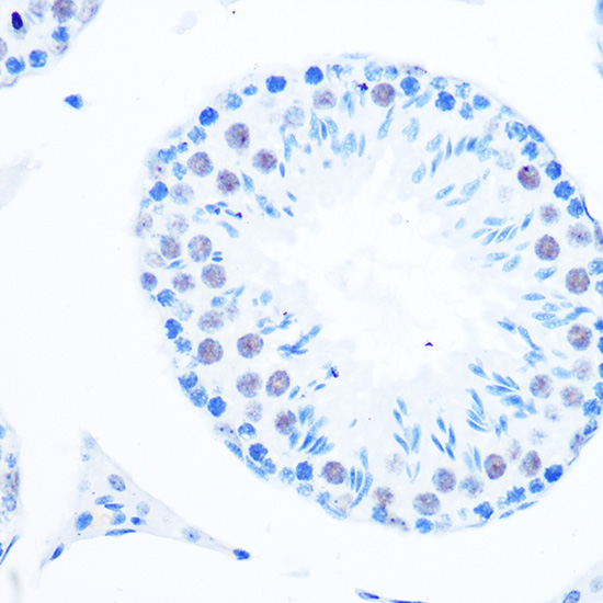 DNA Polymerase beta Rabbit monoclonal antibody