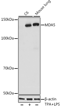 MDA5 Rabbit monoclonal antibody