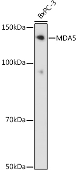 MDA5 Rabbit monoclonal antibody